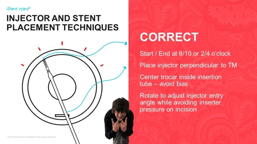 Slide 9